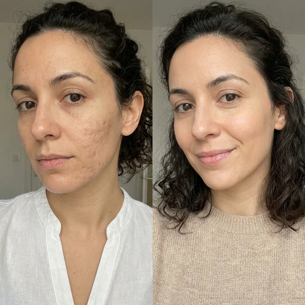 Cristina M. — Tucuman, Argentina